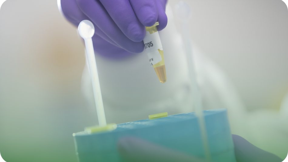 A purple-gloved hand holding up a small vial of urine