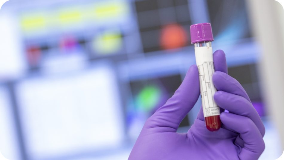 A purple gloved hand holding a vial in a lab